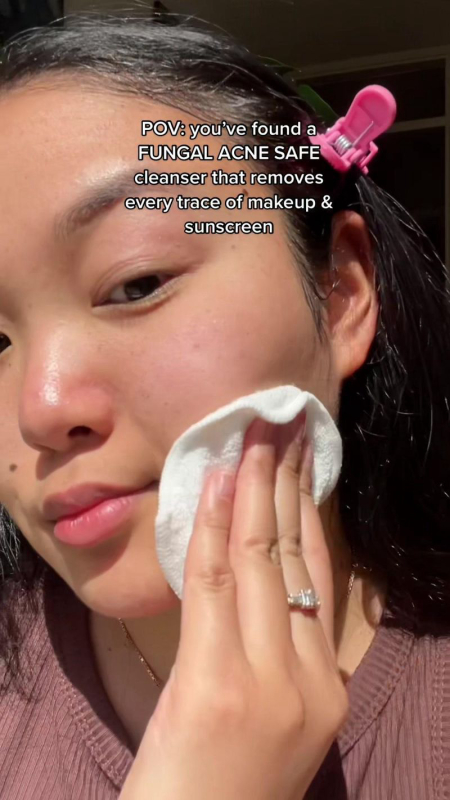 Fungal acne safe cleanser Chare s Beauty